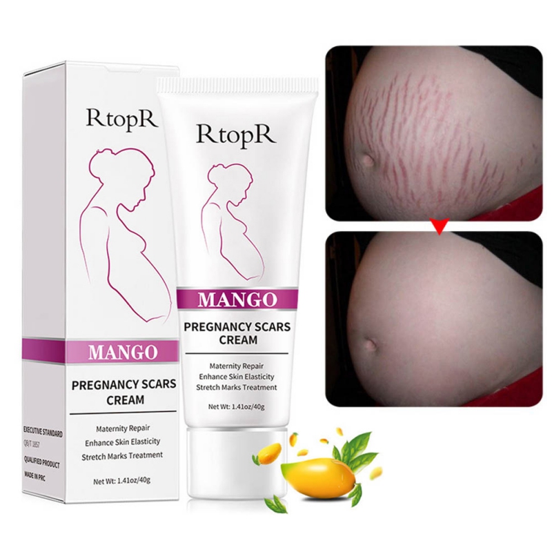 stretch marks on stomach removal cream